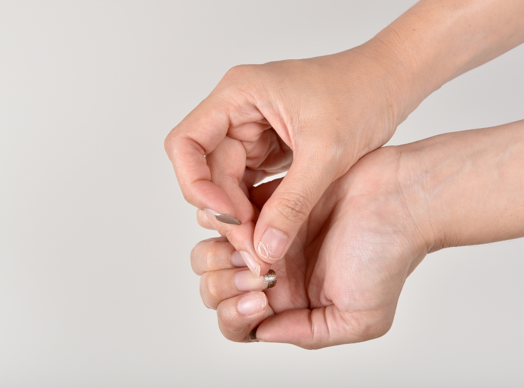 Psoríase nas Unhas: O Sinal que Você Está Ignorando e Pode Indicar Algo Maior