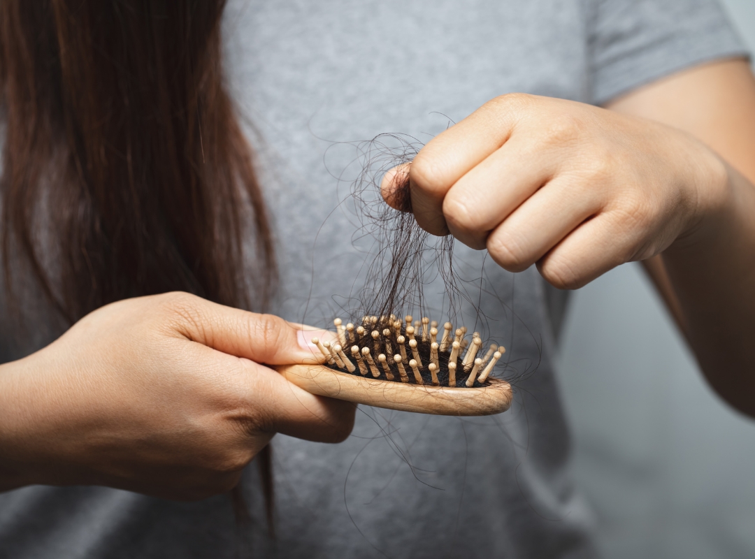 Queda de Cabelo: Entendendo as Causas e Opções de Tratamento