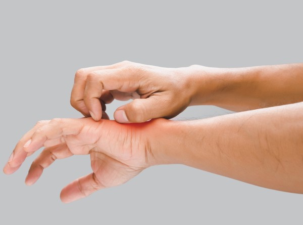 Coceira Sem Motivo? Veja Quando Pode Ser Muito Mais do Que Alergia Comum